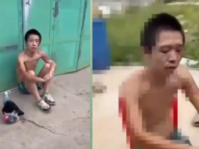 中国小伙浑身伤痕流落柬埔寨，华人老板送药送钱