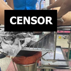 沙缴府农占村发生排雷事故,EOD成员紧急送医院治疗
